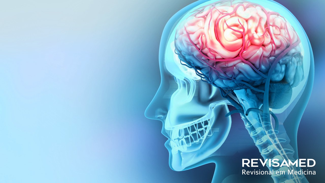 Acidente vascular encefálico hemorrágico (AVEH)